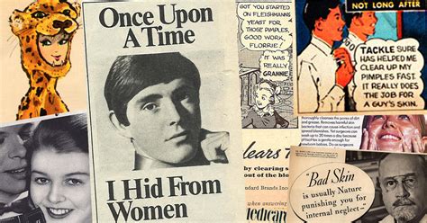 10 vintage acne treatments you will thankfully never have to use again