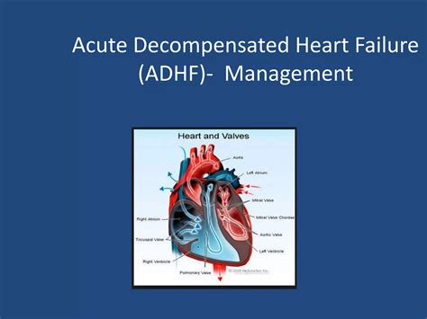Acute Decompensated Heart Failure Ppt
