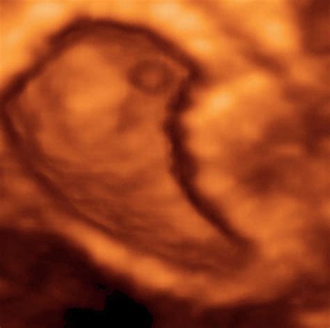 Embryo At 6 Weeks Photograph By Dr Najeeb Layyousscience Photo Library