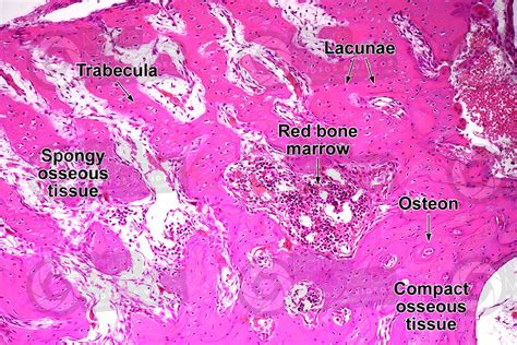 Mammal Spongy Osseous Tissue Transverse Section 125x Spongy