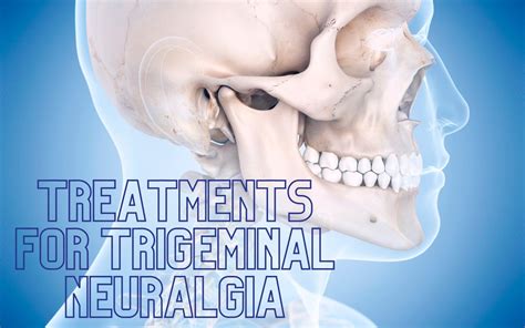 Treatments For Trigeminal Neuralgia London Neurosurgery