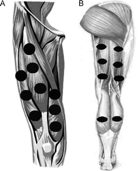 A Treatment Points In Knee Extensor Muscles B Treatment Points In