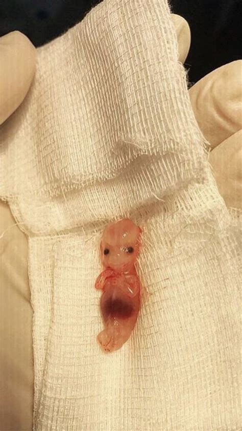 At what age can my conure bath, baby sun conure bathing, bathing baby conures, conure bath,. Picture Of 9 Week Old Fetus - Pregnant Photos