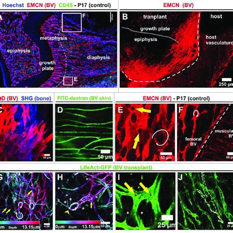 The Morphology Of New Blood Vessels Sprouting From Split Femur