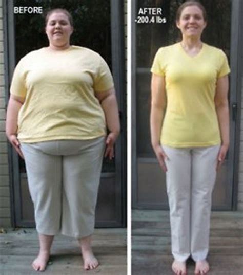Incredible Weight Loss Transformations That Will Wow Gallery