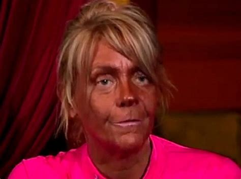 Tan Mom Patricia Krentcil Has Discovered Botox And Says Her Pale Look