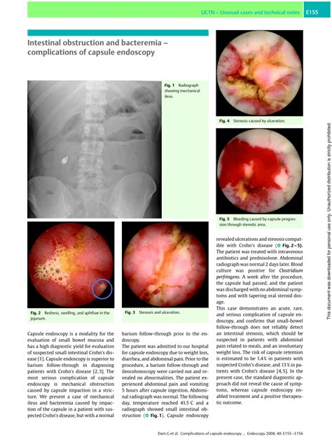 With quick care, treatment usually works well. (PDF) Intestinal obstruction and bacteremia ...