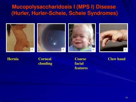 So, it is a syndrome in which the large saccharides are not broken down properly in the lysosomes. PPT - Mucopolysaccharides PowerPoint Presentation, free ...