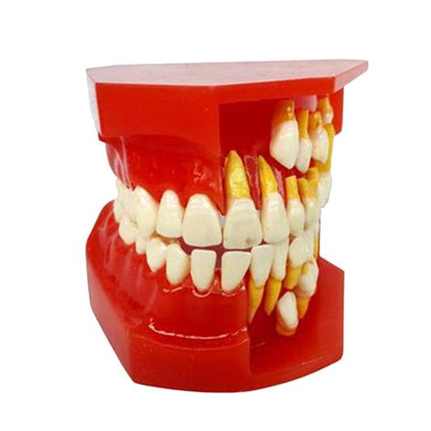 Deciduous Teeth Permanent Tooth Alternate Demonstration Study Teach