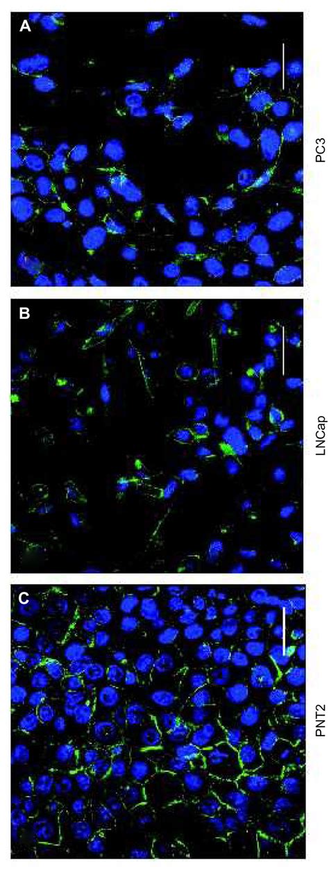 MrP Localization In Prostate Cell Lines Notes A The ABc Download Scientific Diagram