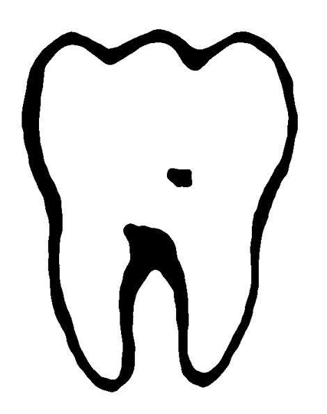 Wisdom Tooth Shape Dental Care Dental Teeth Dental Hygiene Wisdom