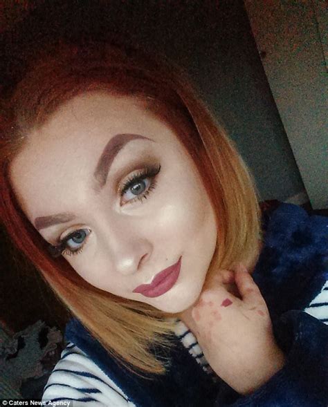 Make Up Artist From Grimsby Inspires Psoriasis Sufferers Daily Mail Online