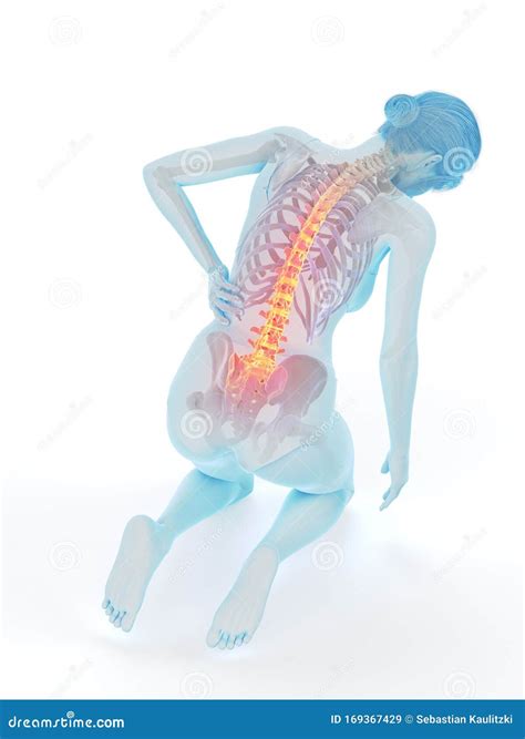 A Woman Having A Painful Back Stock Illustration Illustration Of Hurt