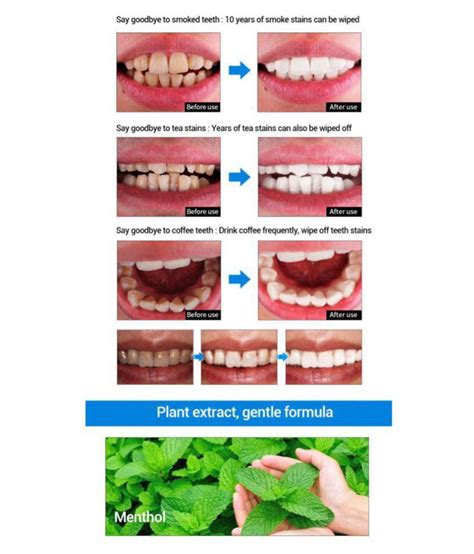 Digitalshoppy Teeth Whitening Gum Ml Buy Digitalshoppy Teeth Whitening