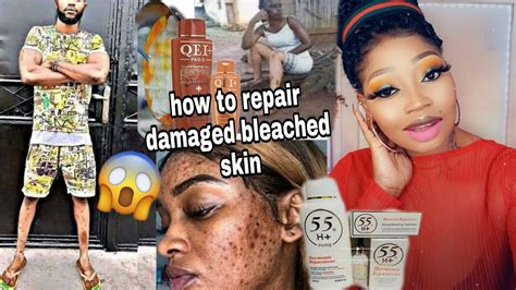 How To Repair Damaged Bleached Skin Best Product To Use After Skin