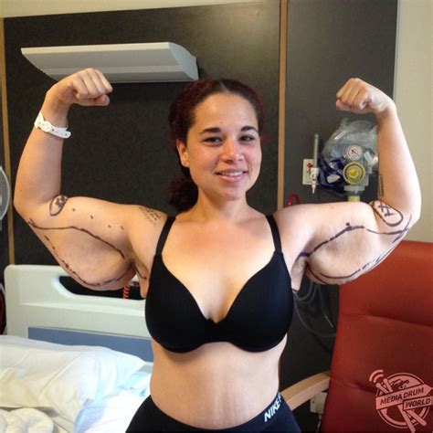 Meet The Woman Whose Extreme Weight Loss Left Her Needing Skin Removal Surgery Media Drum World