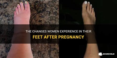 The Changes Women Experience In Their Feet After Pregnancy Shunchild