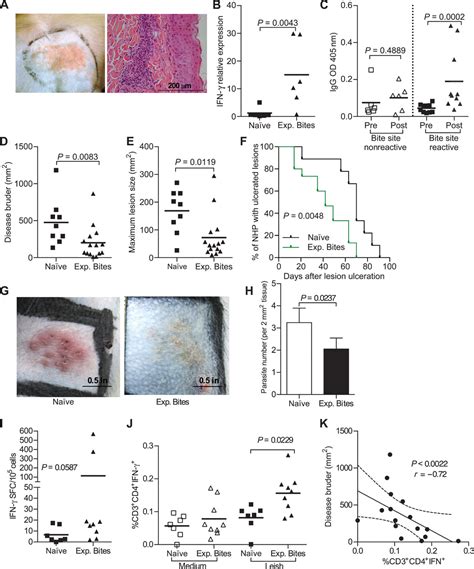 A Sand Fly Salivary Protein Vaccine Shows Efficacy Against Vector Transmitted Cutaneous