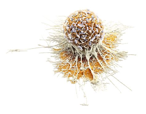 细胞癌变的基本原理及癌症的形成 知乎