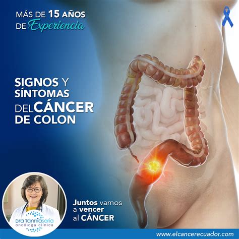 Signos y síntomas del cáncer de colon Dra Tannia Soria Oncóloga