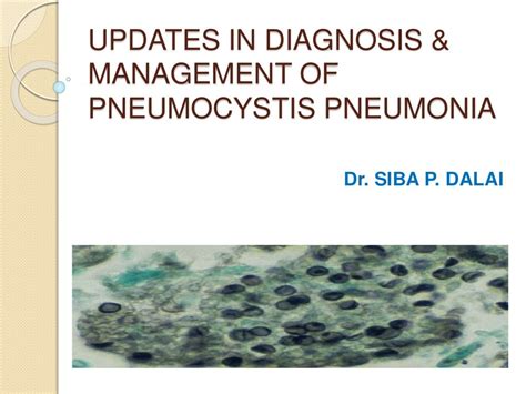 Pneumocystis Pneumonia