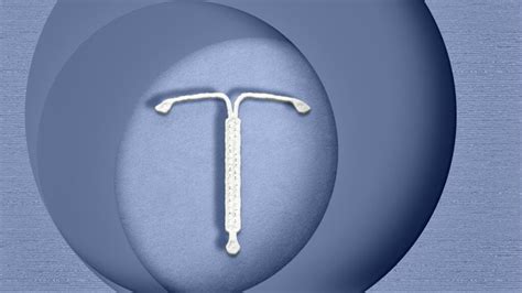 Do Iuds Cause Pelvic Inflammatory Disease What To Know