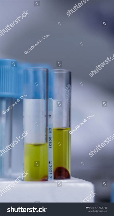 Centrifuged Blood Preparation Platelet Rich Plasma Stock Photo