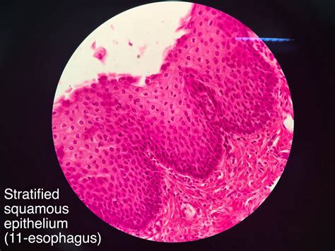 Stratified Squamous Epithelium Non Keratinized Stratified Squamous