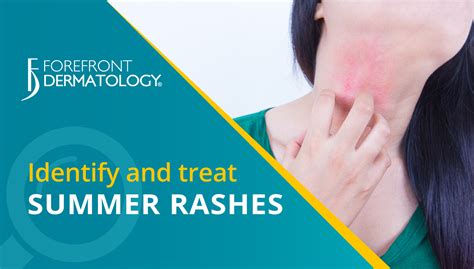 How To Identify And Treat Summer Skin Rashes Forefront Dermatology