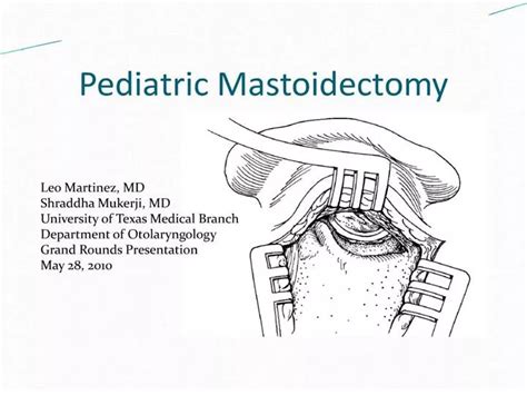 Ppt Pediatric Mastoidectomy Powerpoint Presentation Free Download Id