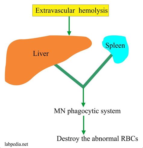 In vivo hemolysis is present in conditions called hemolytic anemias. Anemia - Part 6 - Hemolytic Anemias, Causes and Lab ...