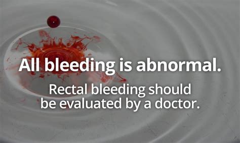 Rectal Bleeding Causes And Treatment Dr Havranek