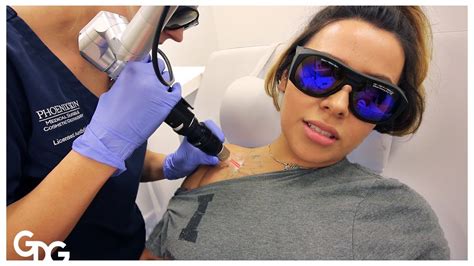 Tattoo ink is placed beneath the top layer of the skin. Removing A Tattoo - YouTube