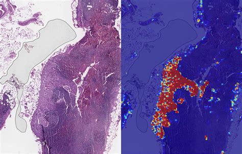 Leos are radiant, creative forces that light up the zodiac. Google's AI is now better than doctors at spotting breast ...