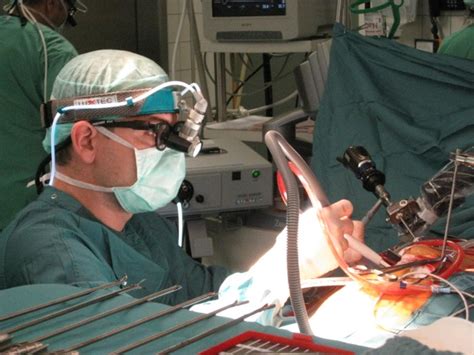 Minimally Invasive Keyhole Technique The Centre For Heart Surgery