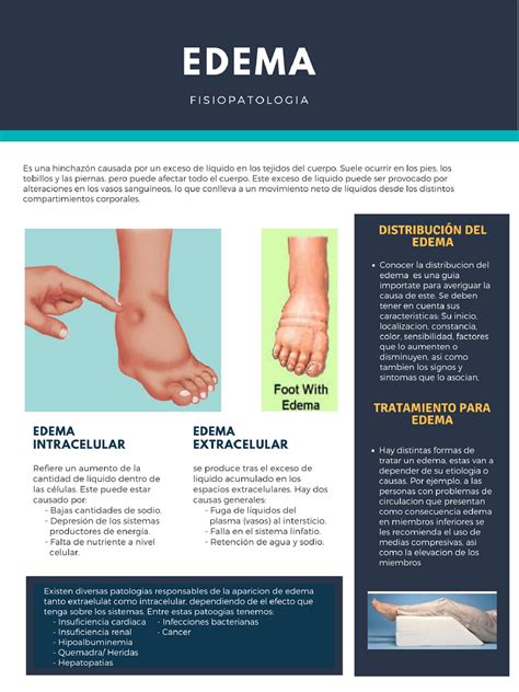 Edema Infografia Simple Para Comprension De Paciente Edema