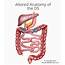 Anatomy And Physiology Of The Duodenal Switch DS %  ObesityHelp