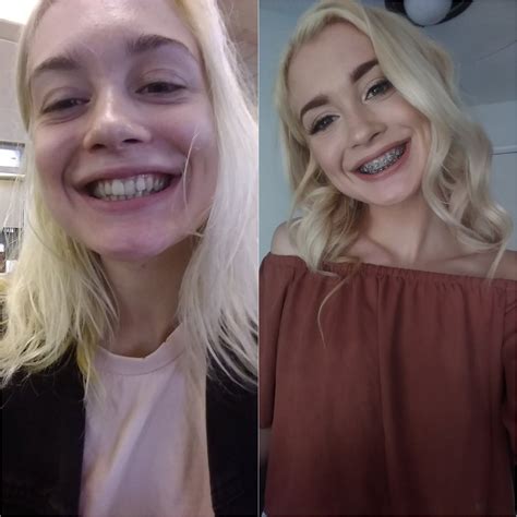 [anastasia knight 18] anyone looking forward to some brace face and teen themed porn from her