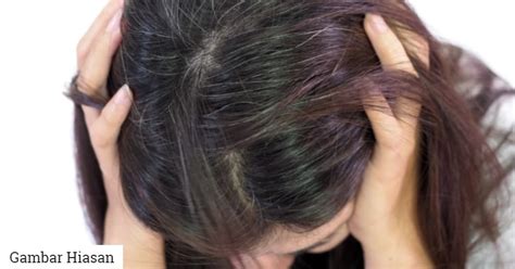 Tak Perlu Dye Hitam Guna 5 Bahan Ini Untuk Menghitamkan Rambut Anda