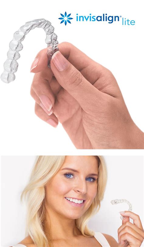 Invisalign Lite Uses Invisible Clear Braces For Minor Teeth