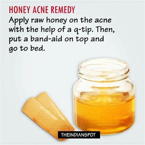 honey acne remedy honey for acne acne remedies natural acne remedies