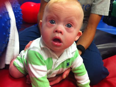 Many babies who have down syndrome do not have good muscle tone, which makes it harder for them to roll over and walk. 4 Reasons An Exercise Ball Is Great For Hypotonia in Down ...