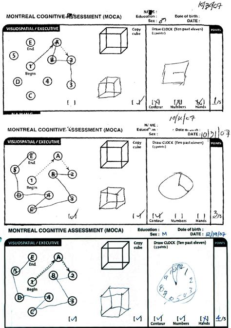 Moca scoring nuances with clock draw : cognitive assessment_Elec-Intro Website
