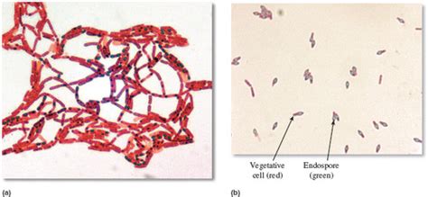 Spore Differential Staining Flashcards Quizlet