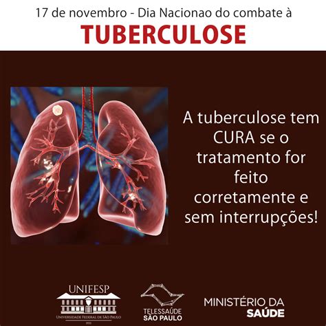 A Tuberculose Continua Sendo Considerada Um Importante Problema De Saude