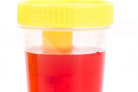 Pewarna makanan jingga / food coloring orange 1,000gr. Ini 10 Arti Warna Urine terhadap Kesehatanmu - PelangiKoin ...