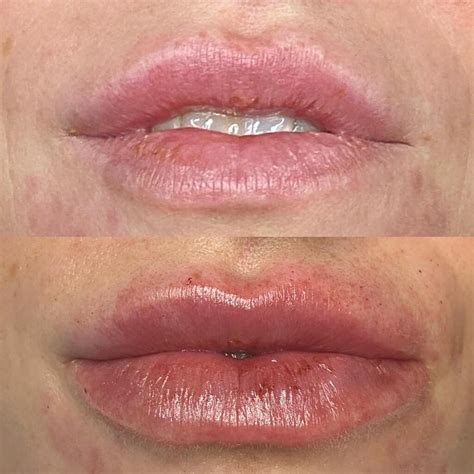 Our Clients Contour Lip Fillers And Permanent Makeup
