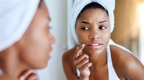 Can Vitiligo Lead To Skin Cancer Everyday Health