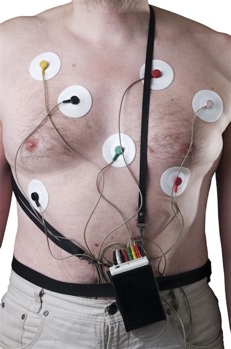 Cpt Code Holter Monitor