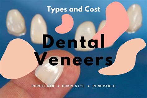 Guide To The Types Of Veneers And Cost In The Uk Muswell Hill Smile